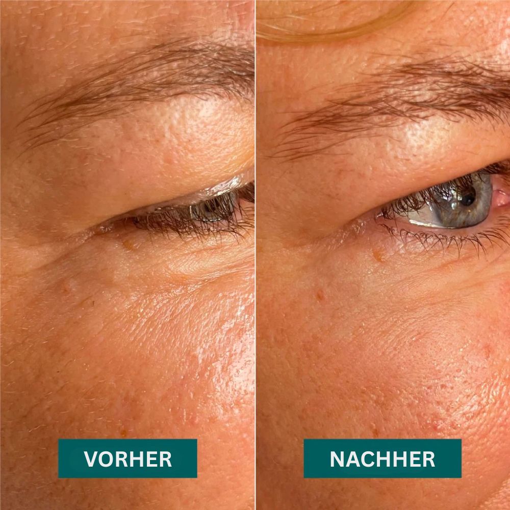 APRICOT Augen-Schläfen Pads "aloe there" mit Aloe Vera · 30 Behandlungen – Bild 4