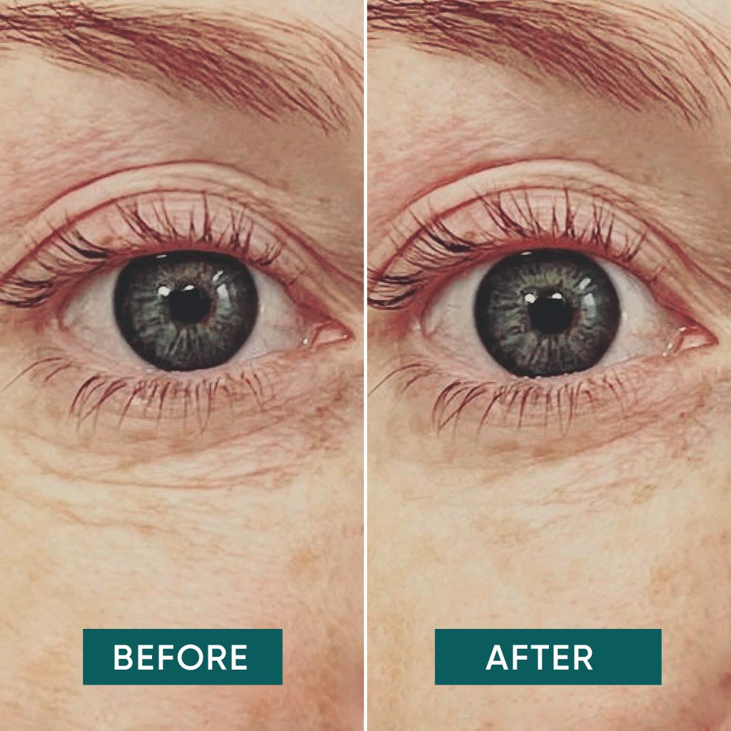 APRICOT Augen Pads „Glow Getter“ mit Vitamin C · 30 Behandlungen – Bild 4